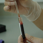 Blood test